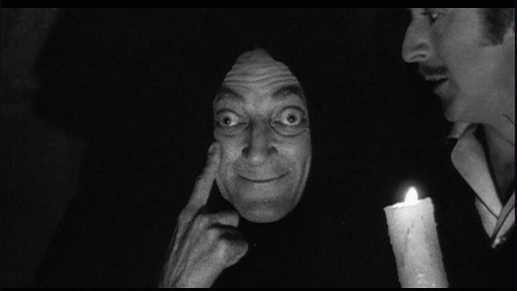 Marty Feldman como Igor no filme "O Jovem Frankenstein", de 1974